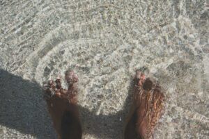 Read more about the article Eczema: My Personal Journey